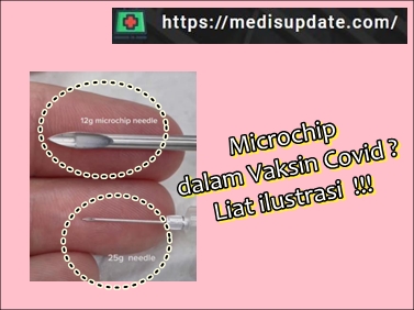 Microchip dalam vaksin Covid