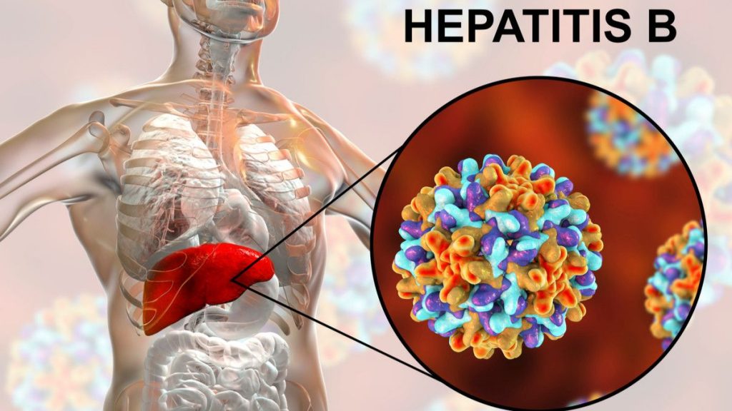 Hepatitis 